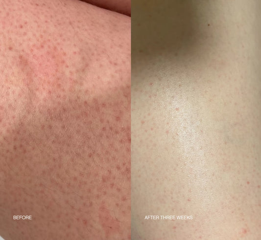 TOPICALS - Slather Exfoliating Body Serum