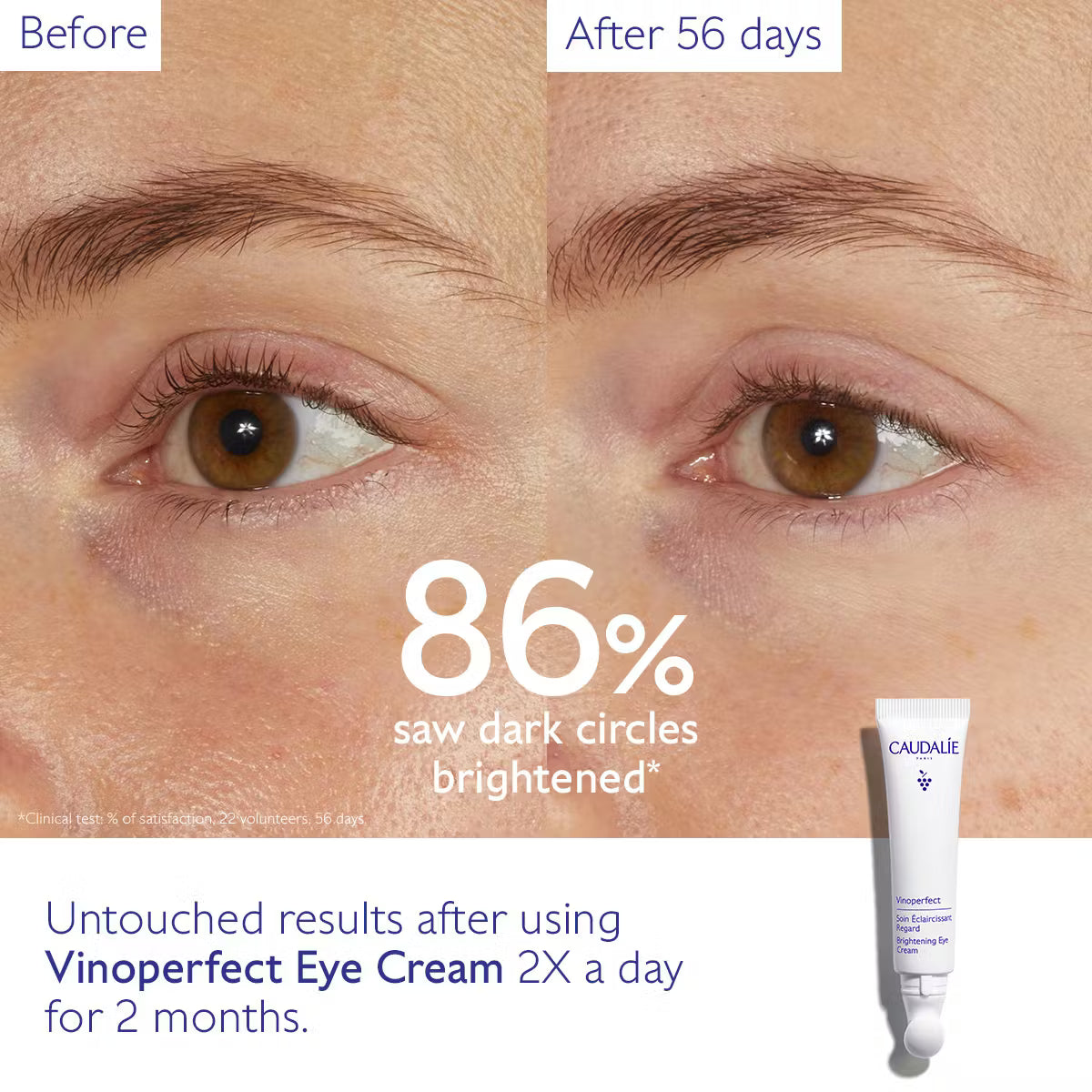Caudalie - Vinoperfect Dark Circle Brightening Eye Cream with Niacinamide