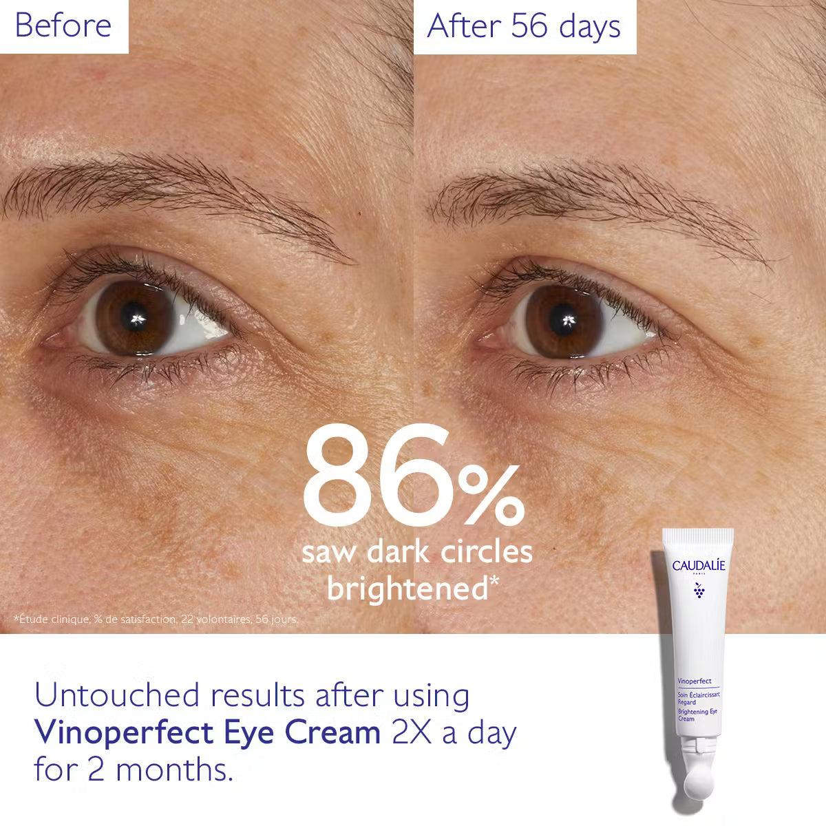 Caudalie - Vinoperfect Dark Circle Brightening Eye Cream with Niacinamide