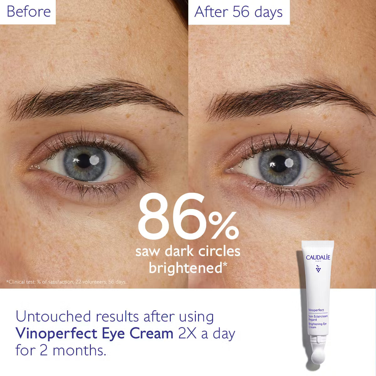 Caudalie - Vinoperfect Dark Circle Brightening Eye Cream with Niacinamide