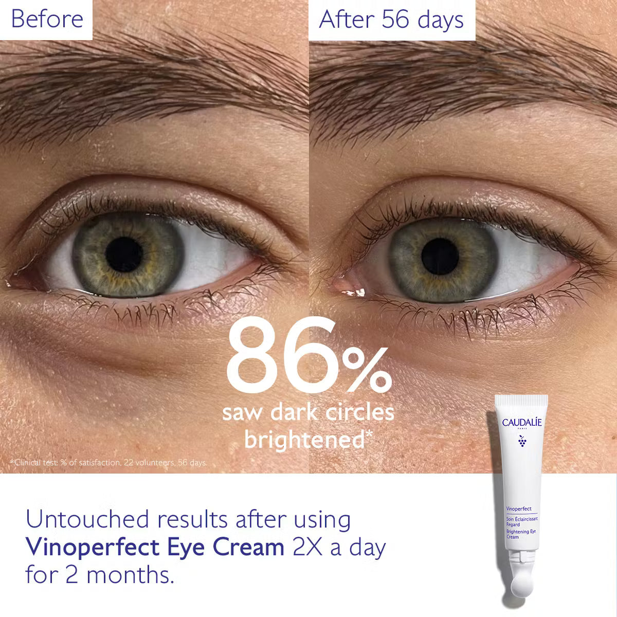 Caudalie - Vinoperfect Dark Circle Brightening Eye Cream with Niacinamide