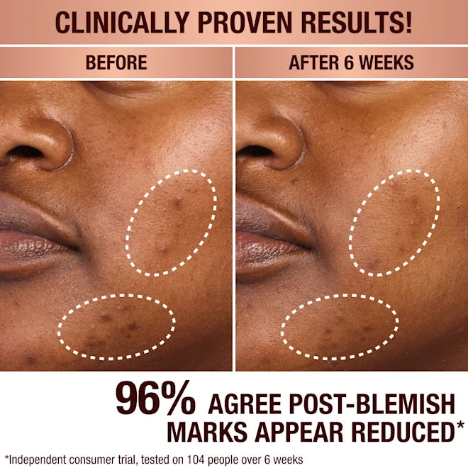 Charlotte Tilbury - Dark Spot Correcting Radiance Recovery Serum