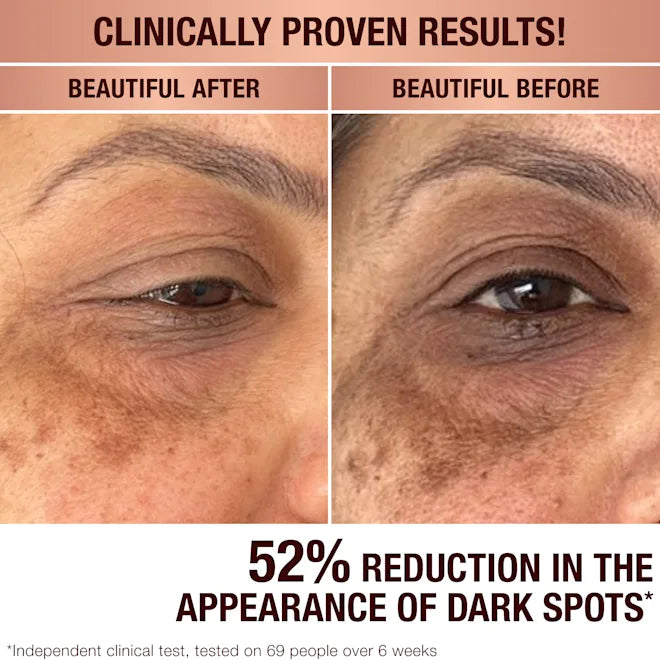 Charlotte Tilbury - Dark Spot Correcting Radiance Recovery Serum