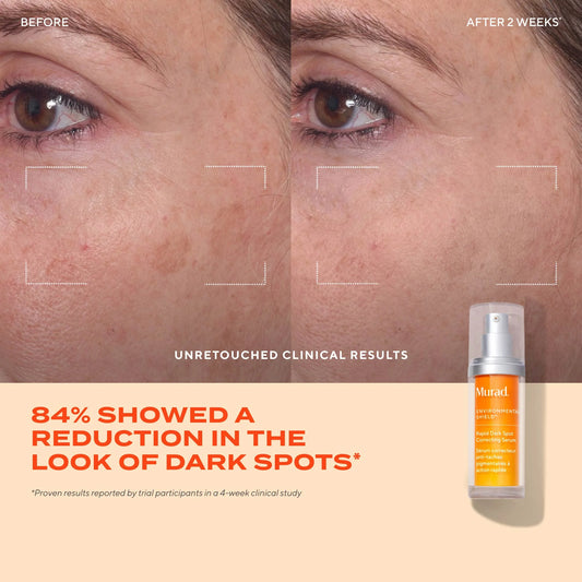 Murad - Rapid Dark Spot Correcting Serum - Brandz On Demand - Premium, 100% Original Beauty and Lifestyle Products - Pakistan