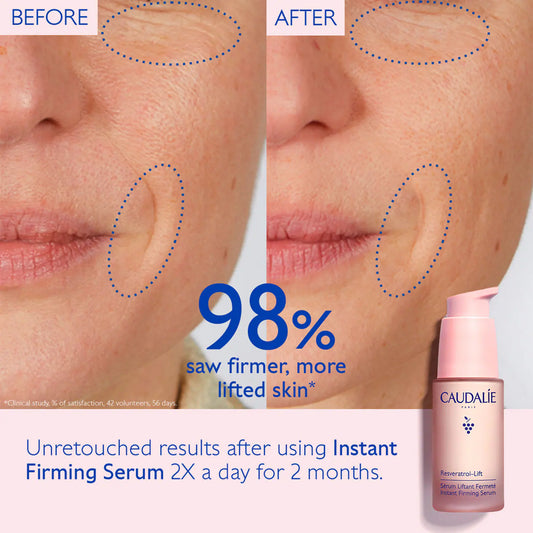 Caudalie Resveratrol Lift Instant Firming Refillable Retinol Alternative Serum - Brandz On Demand - Premium, 100% Original Beauty and Lifestyle Products - Pakistan
