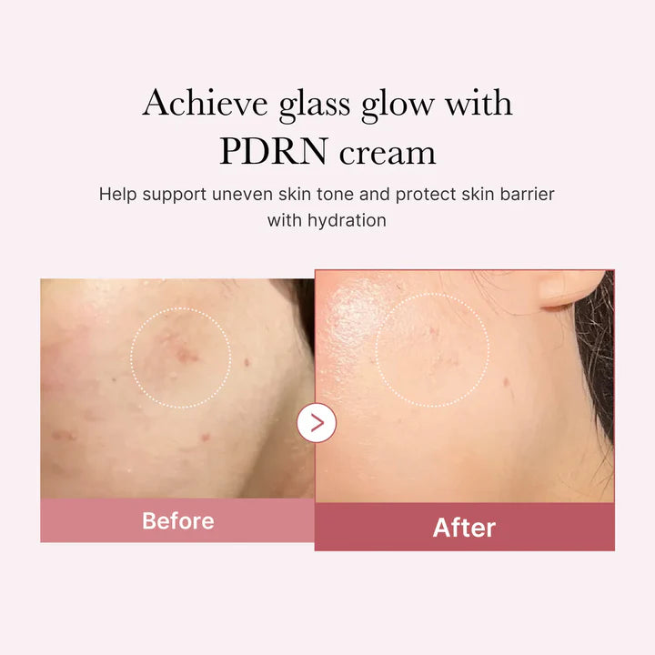 Medicube Salmon DNA PDRN Pink Hyaluronic Moisturizing Cream