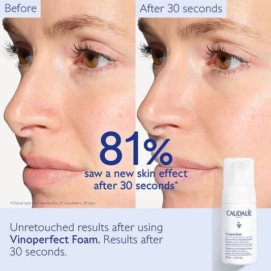 Caudalie - Vinoperfect Brightening Micropeel with Mandelic Acid (AHA) Cleansing Foam - Brandz On Demand - Premium, 100% Original Beauty and Lifestyle ProductsΒ - Pakistan