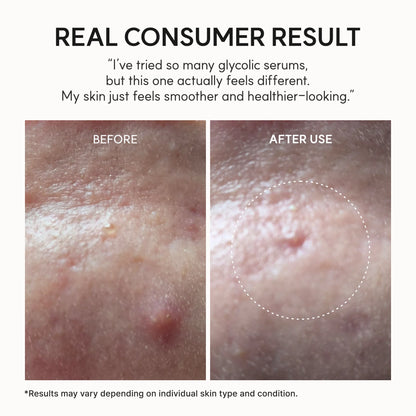 Arencia - Eraser Shot Glycolic Acid Booster Serum