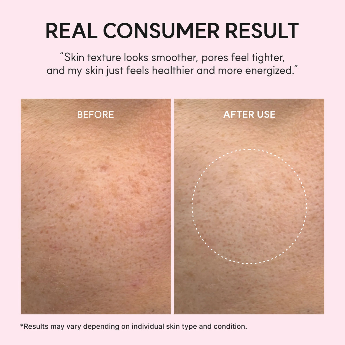 Arencia - PDRN Booster Shot Serum