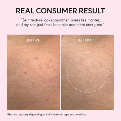 Arencia - PDRN Booster Shot Serum