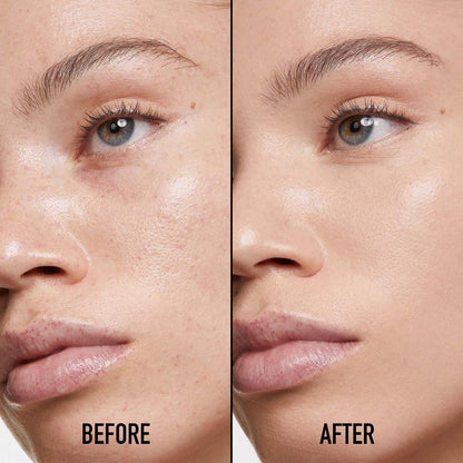 Dior - Forever Skin Correct Full-Coverage Concealer