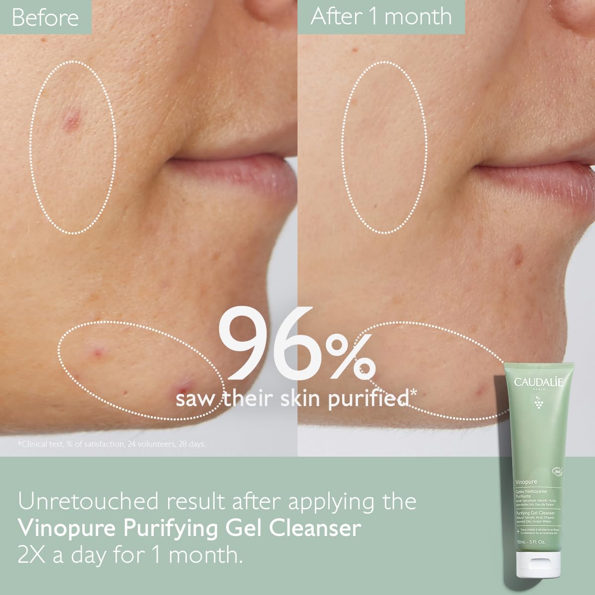 Caudalie - Vinopure Salicylic Acid Cleanser