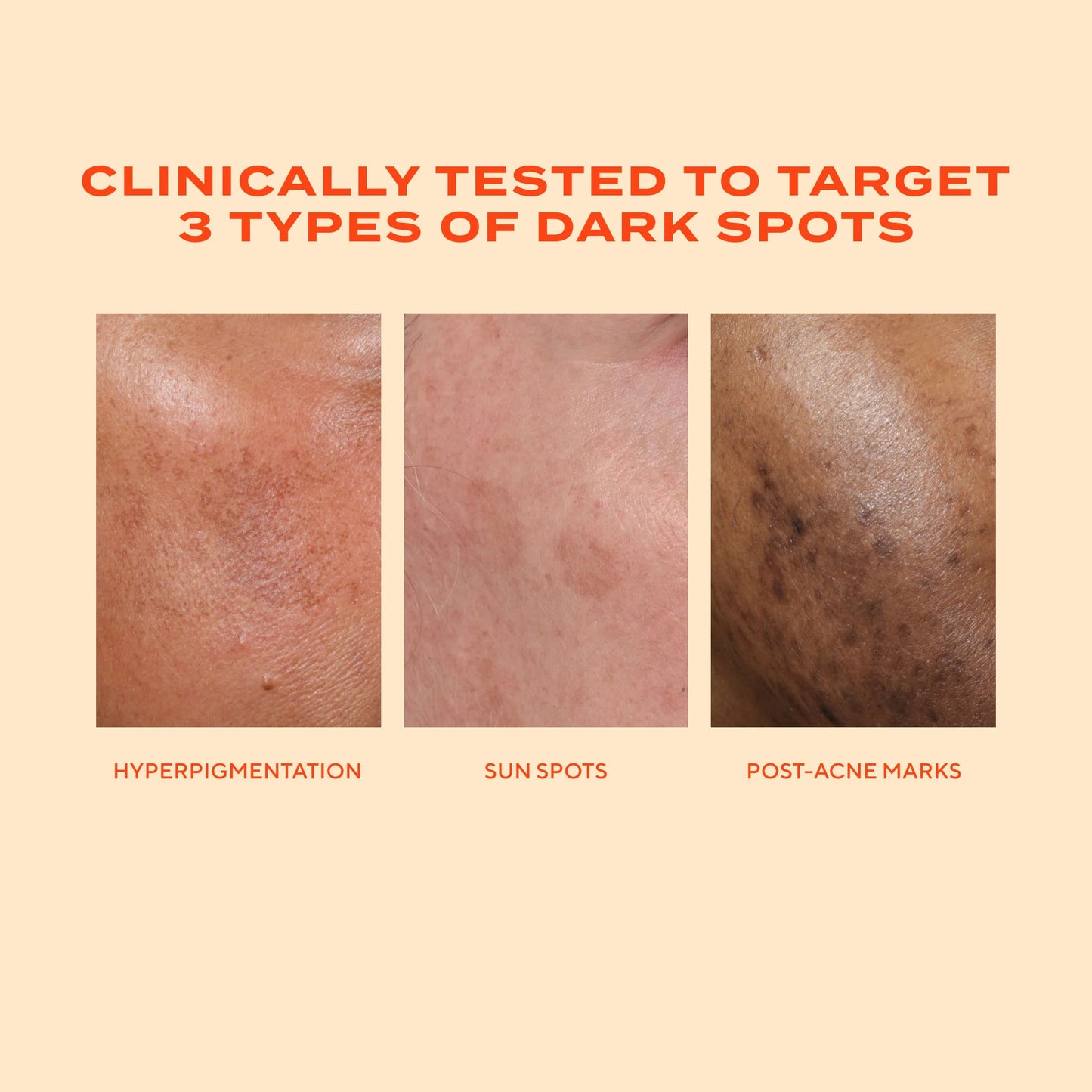 Murad - Rapid Dark Spot Correcting Serum