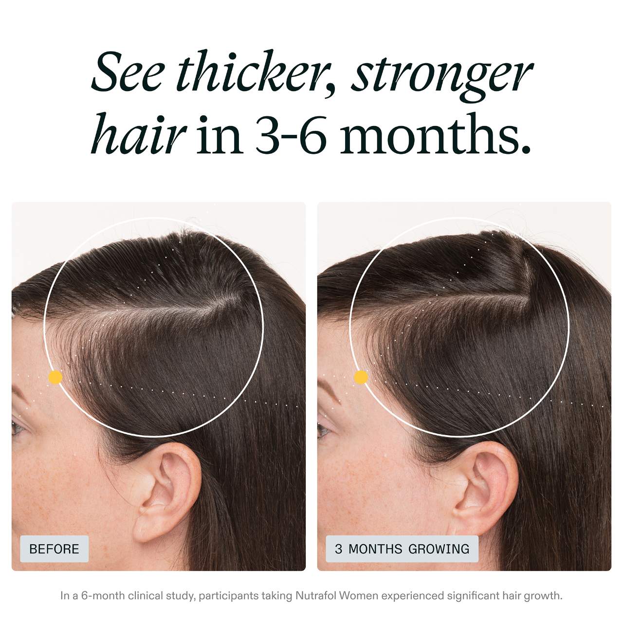 Nutrafol - Women Clinically Proven Hair Growth Supplement for Thinning