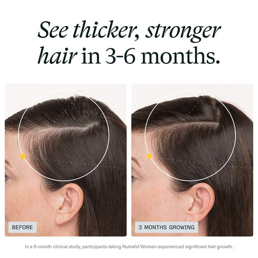 Nutrafol - Women Clinically Proven Hair Growth Supplement for Thinning