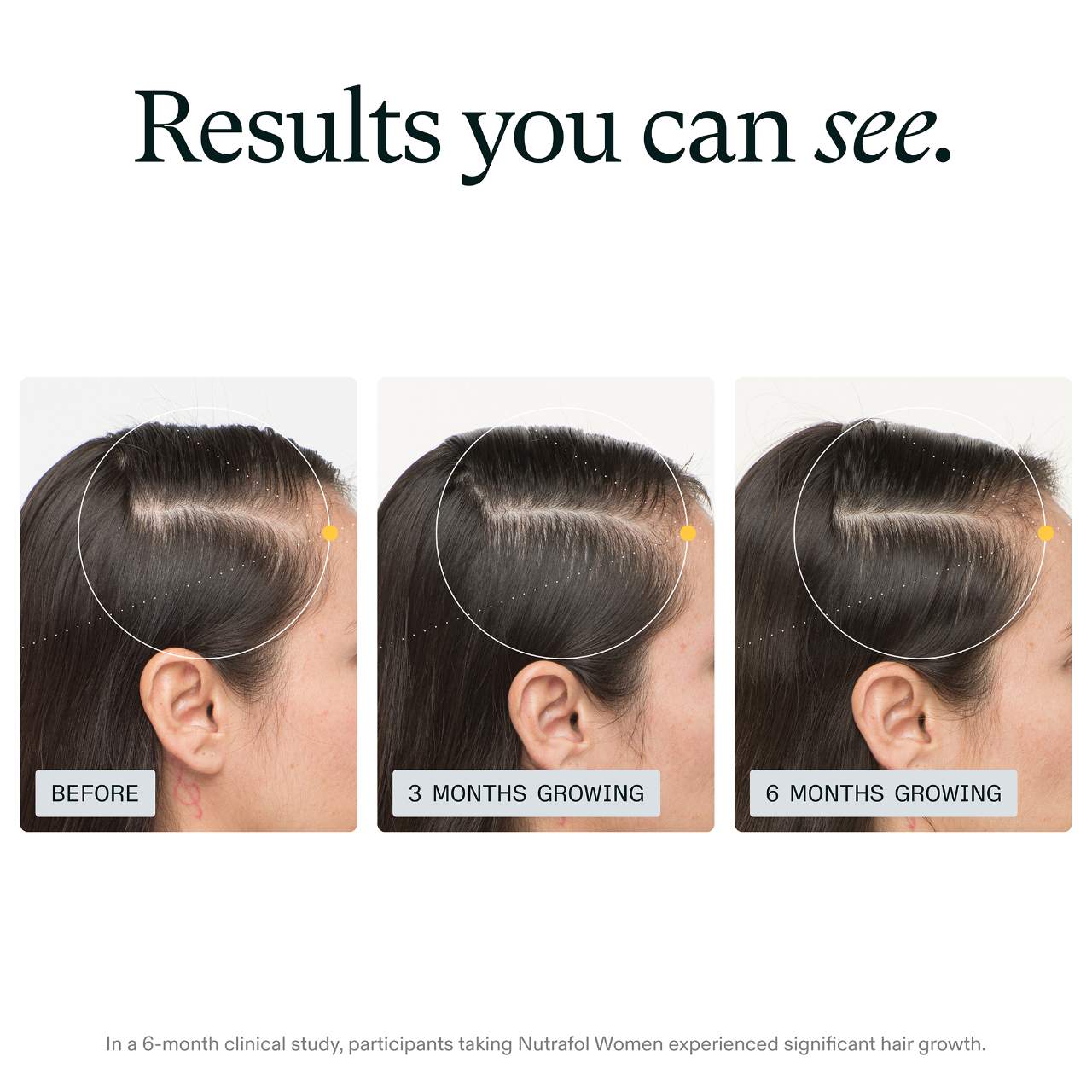 Nutrafol - Women Clinically Proven Hair Growth Supplement for Thinning