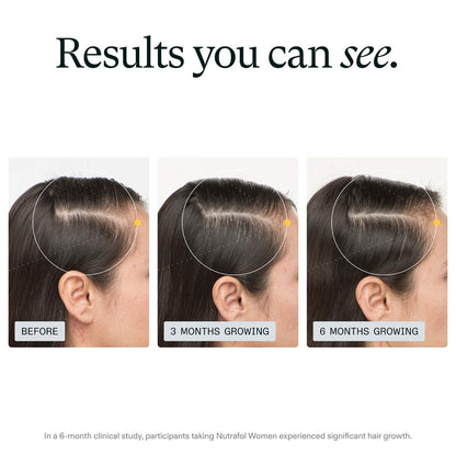 Nutrafol - Women Clinically Proven Hair Growth Supplement for Thinning