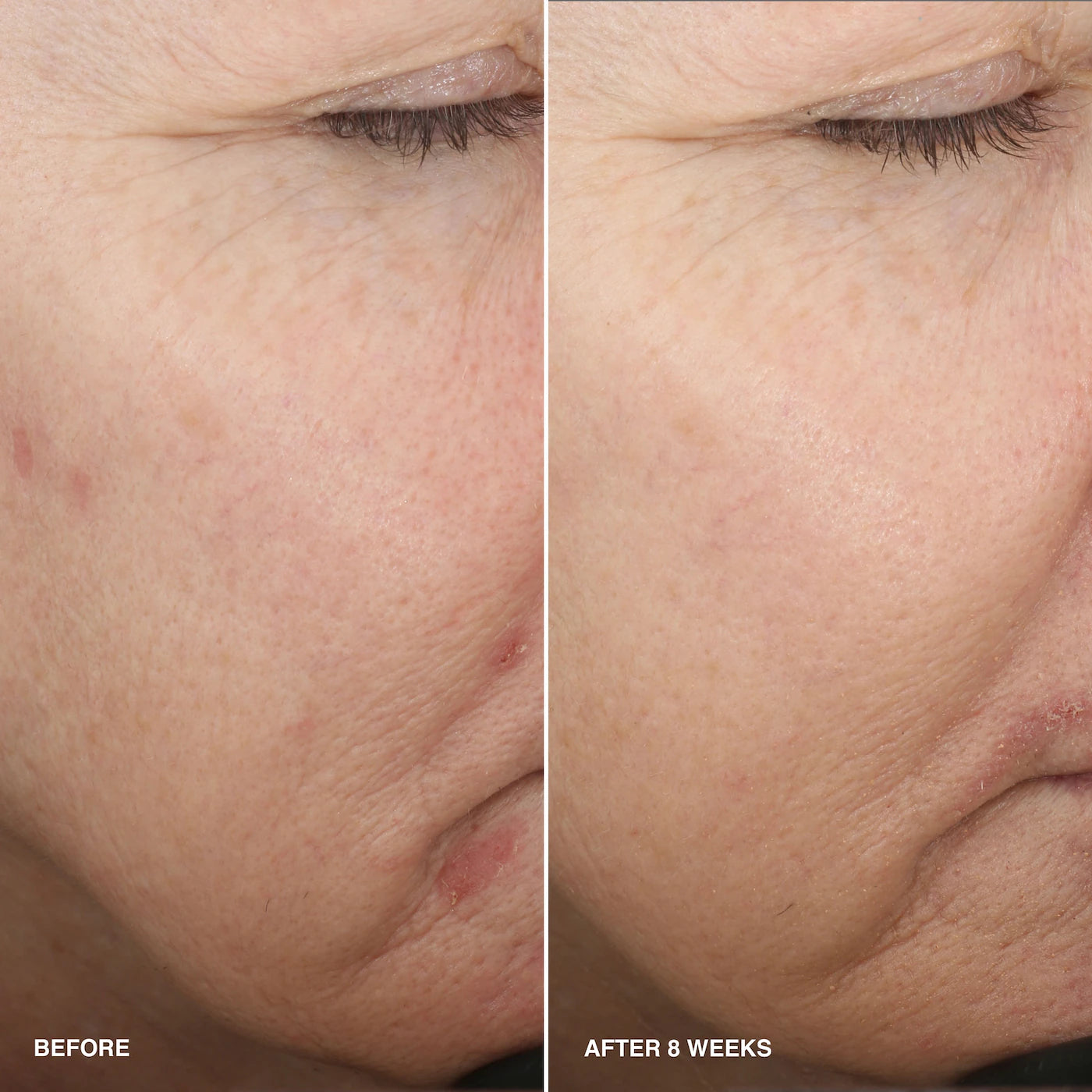 Bobbi Brown - Vitamin Enriched Smoothing Serum