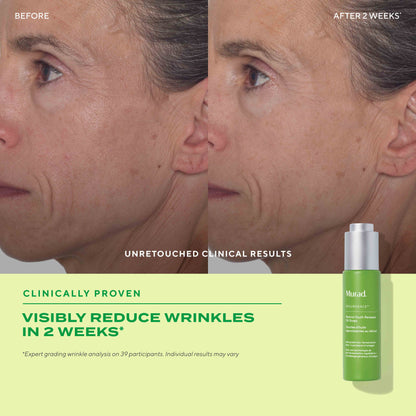 MURAD - Retinol Youth Renewal Face Oil Drops