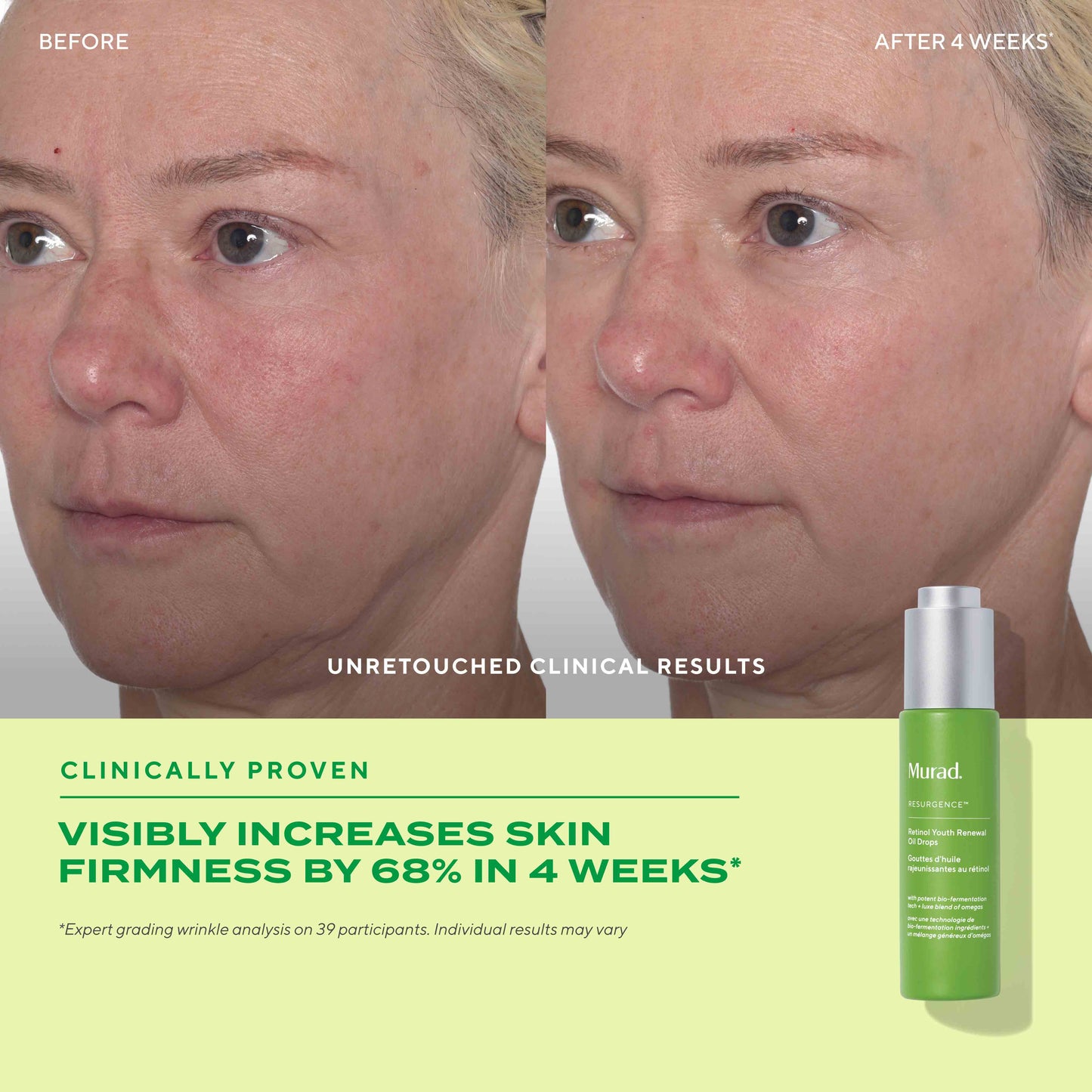 MURAD - Retinol Youth Renewal Face Oil Drops