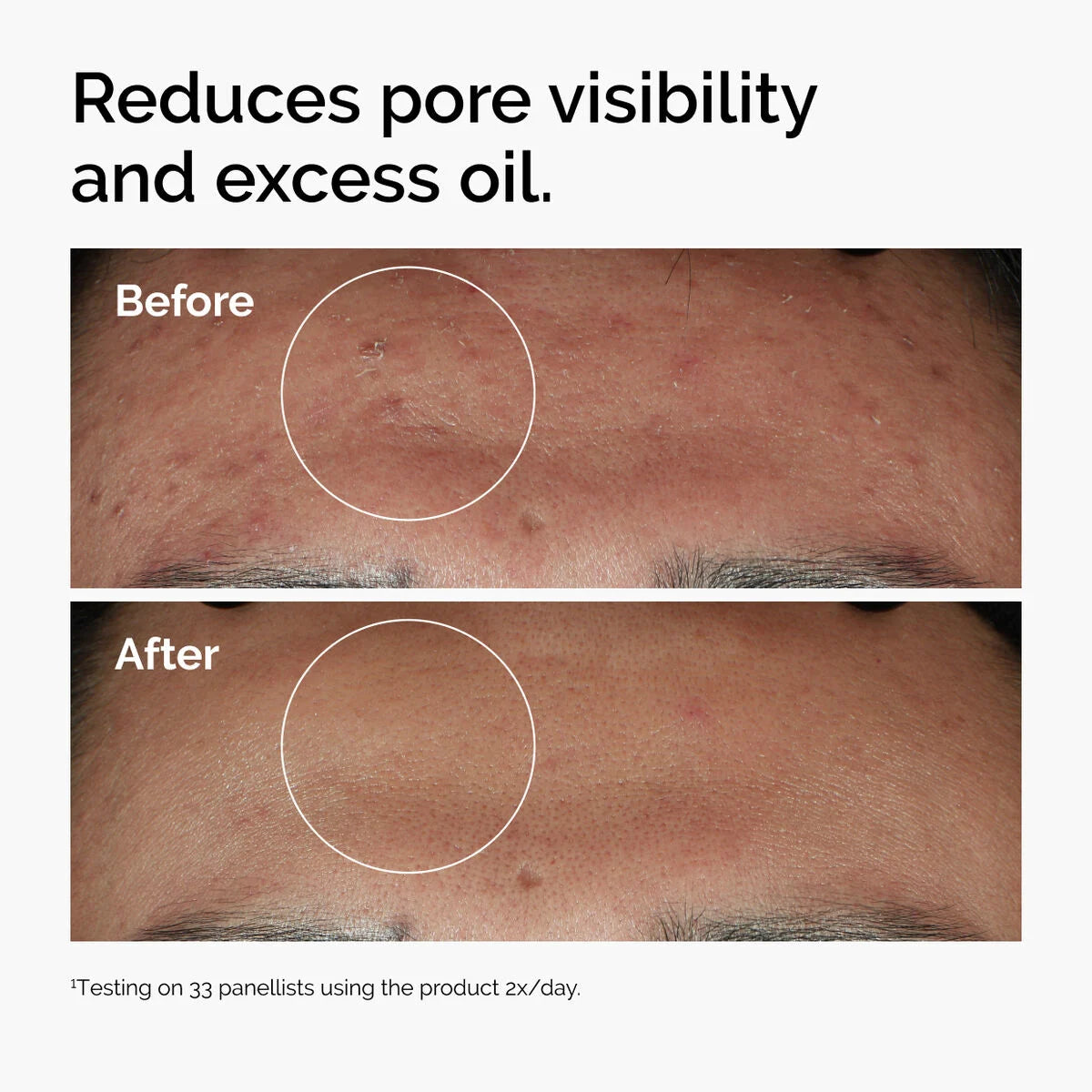 The Ordinary - Niacinamide 10% + Zinc 1%