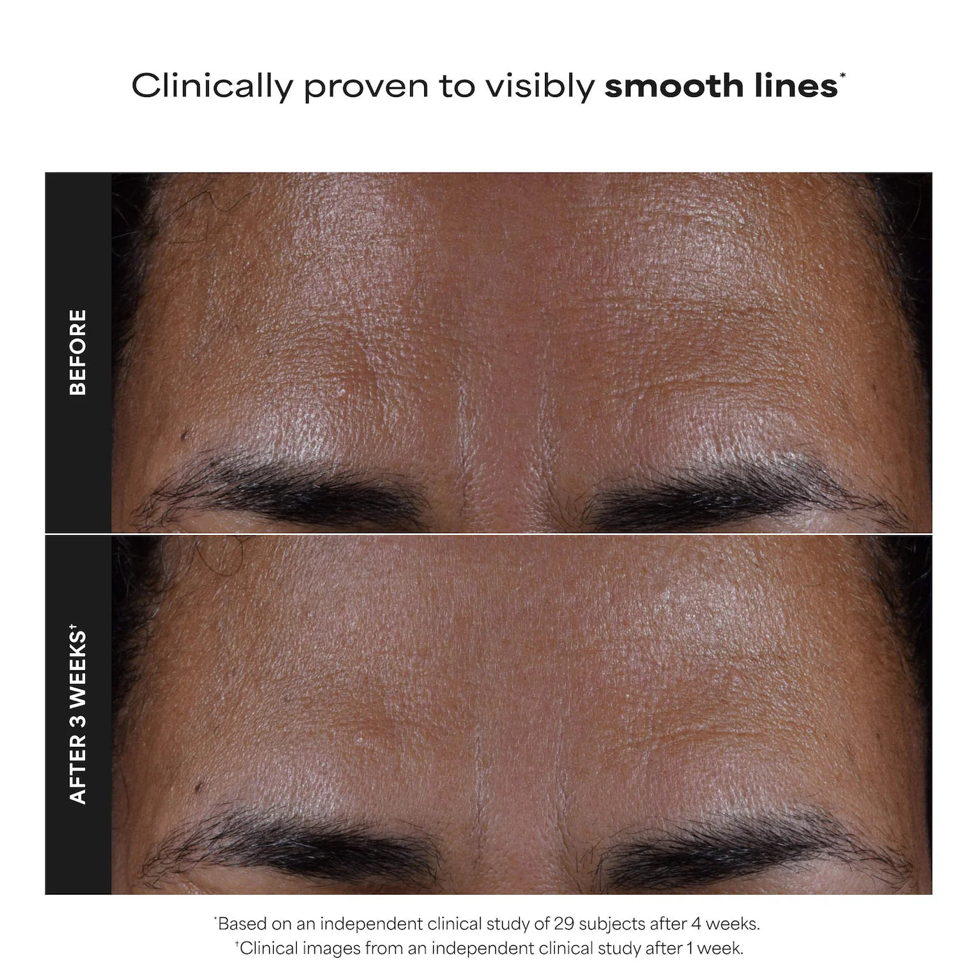 Paula's Choice - Skin Perfecting 2% BHA Exfoliating Toner