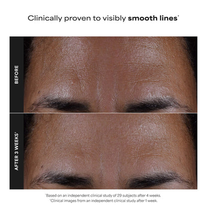 Paula's Choice - Skin Perfecting 2% BHA Exfoliating Toner