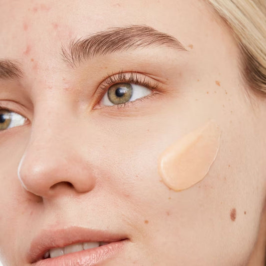 Peace Out  Acne Gel Cleanser
